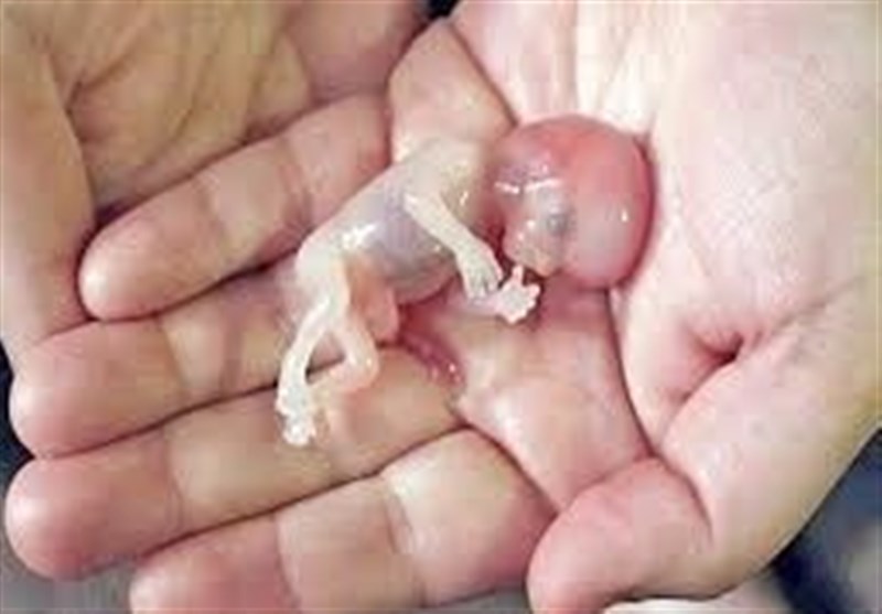 صدور کیفرخواست برای ۹ متهم پرونده سقط جنین غیرقانونی در گلستان