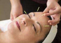 درد میگرن پس از انجام طب سوزنی روی گوش کاهش می یابد! درد میگرن پس از انجام طب سوزنی روی گوش کاهش می یابد!